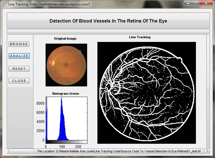 Image matlab. Matlab проекты. eye в матлабе. сегментация в matlab. matlab, черно белые.