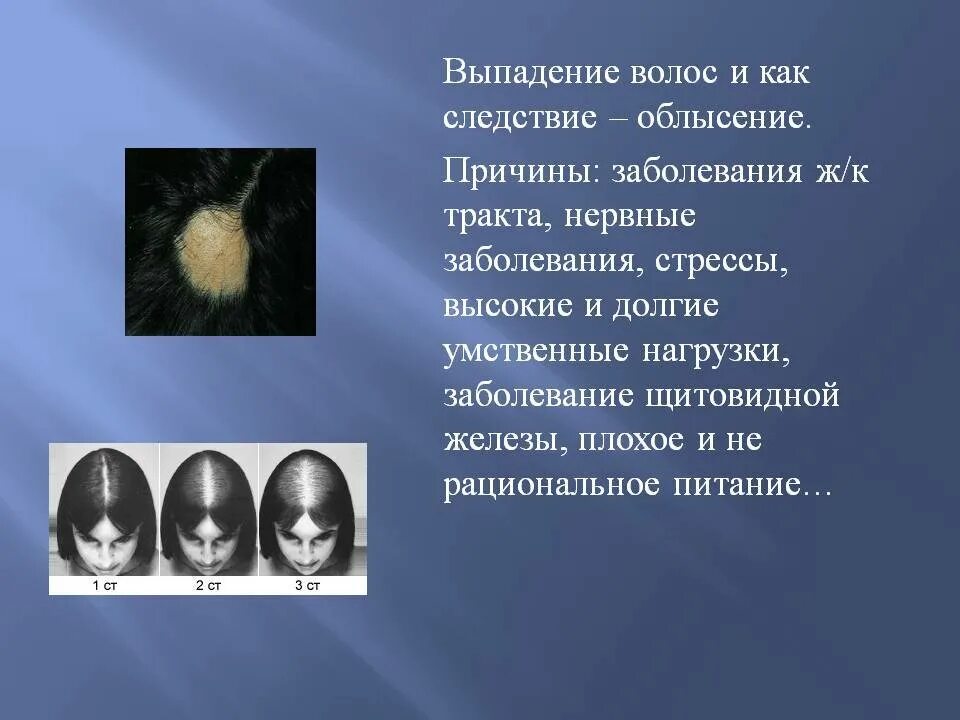 Почему выпадают сильно волосы причина. Причины заболевания волос. Выпадение волос факторы.