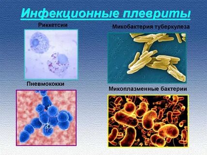 Этиология патогенез плеврита