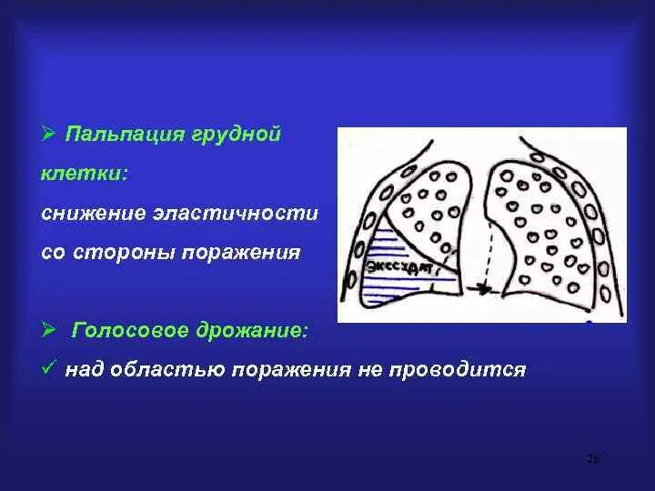 Зоны податливости слизистой. Податливость слизистой оболочки. Эластичность грудной клетки снижена. Пальпация грудной клетки голосовое дрожание. Зоны податливости слизистой оболочки по Люнду.