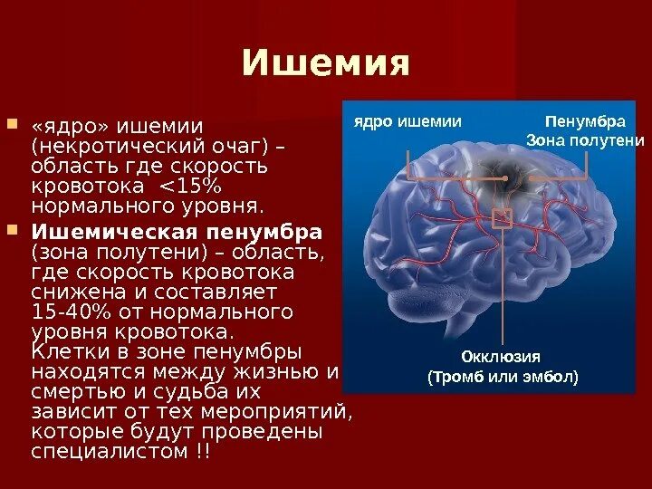 Ишемия состояние. Ядро ишемии. Скорость кровотока при ишемии.