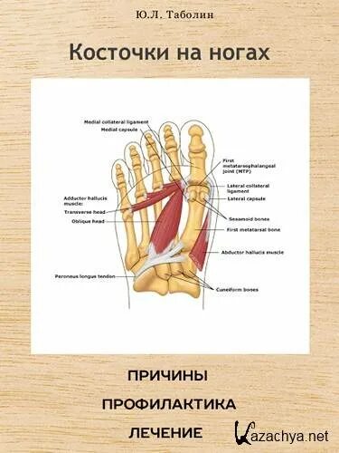 Вальгусная деформация 1 пальца стопы. Косточка на стопе причины. Косточка на стопе причины. Косточка на стопе причины. Косточки на ногах причины возникновения.