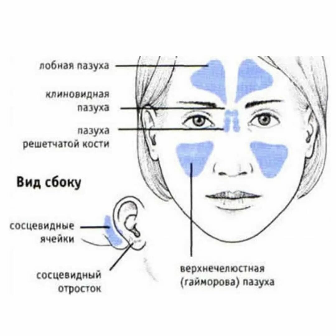 Болит переносица при нажатии насморка. Синусит придаточных пазух. Гайморовы пазухи это придаточные пазухи носа. Околоносовые пазухи анатомия функции. Околоносовые пазухи схема.
