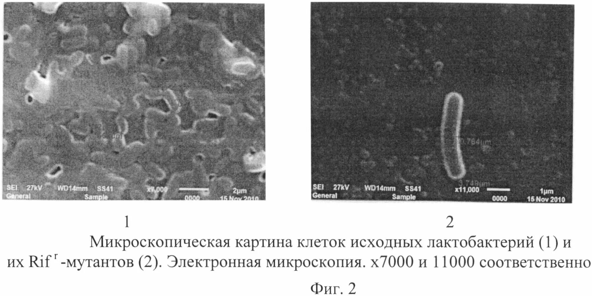 Бифидобактерии в кале. Бифидобактерии микроскопия. Бифидо и лактобактерии в желудке. Бифидобактерии кишечника микроскопия. Лактобактерии для желудка.