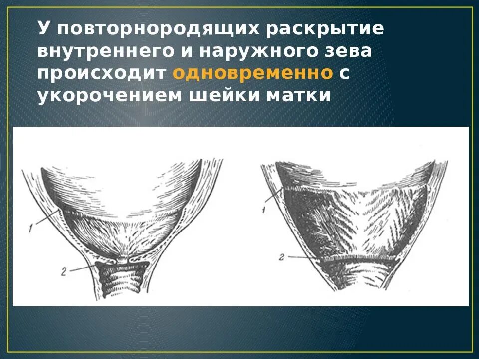 Наружный и внутренний зев. Наруный и внутренний зе. Наружный и внутренний зев матки.