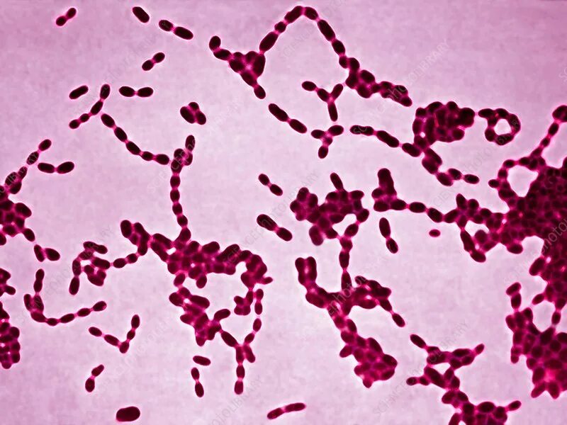 Haemophilus influenzae микробиология. Гемофильная палочка микроскопия. Haemophilus spp у мужчин