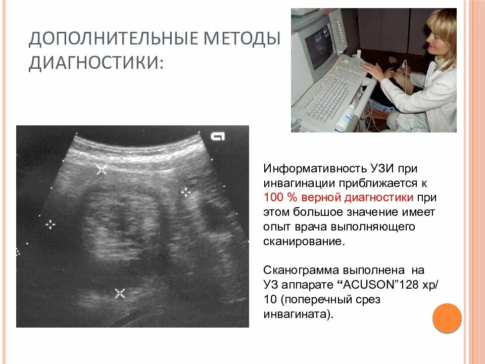 Острая кишечная непроходимость УЗИ. Инвагинация тонкого кишечника УЗИ. Инвагинация кишечника по УЗИ. Инвагинация кишечника на УЗИ. Узи кишечника как подготовиться