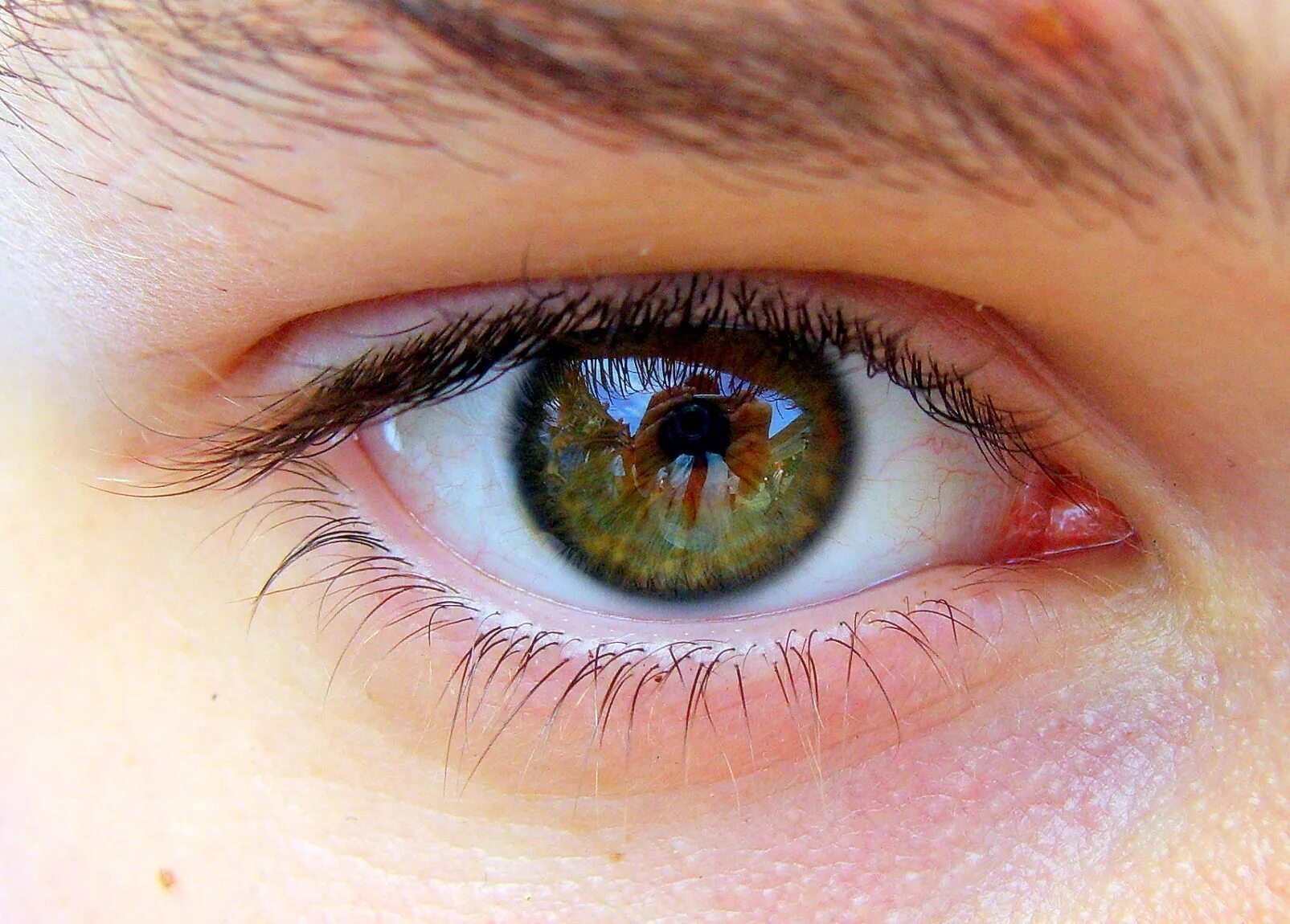 На свету глаз слепнет. Здоровые глаза. Здоровый глаз человека. Глаз человека. Здоровый глрз.