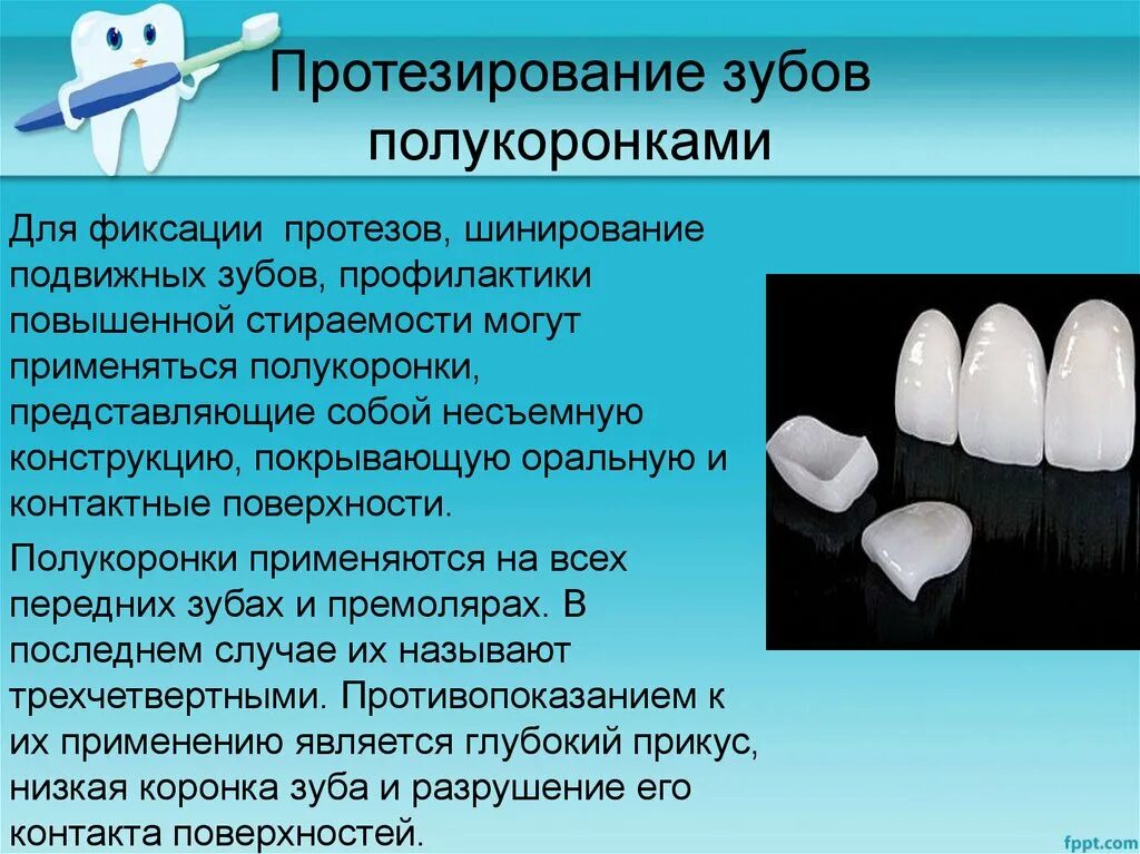 Противопоказания к изготовлению коронки. Полукоронка препарирование. Изготовление полукоронки.