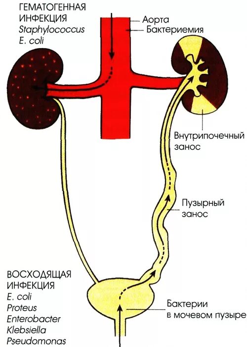 Заболевания почек и мочевого пузыря. Пути проникновения инфекции а мочевой пузырь и почки. Пути проникновения инфекции в мочевые пути. Восходящий путь инфицирования мочевыводящих путей. Восходящий путь инфекции мочевой.