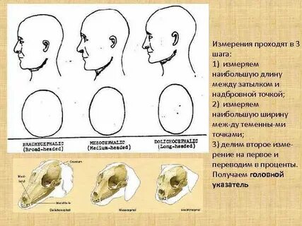 Долихоцефалия