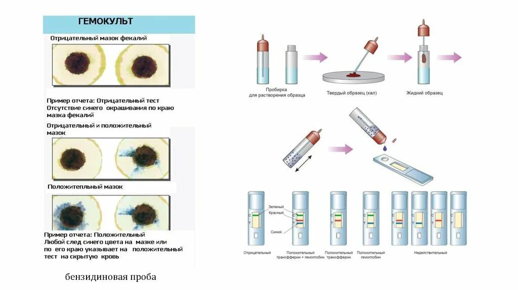 Тесты выявление скрытого. Проба Грегерсена (бензидиновая проба).. Бензидиновая проба на скрытую кровь методика. Бензидиновая проба на скрытую кровь методика проведения. Бензидиновая проба на скрытую кровь в Кале.