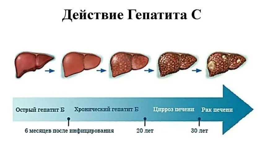 Печень в 3 года