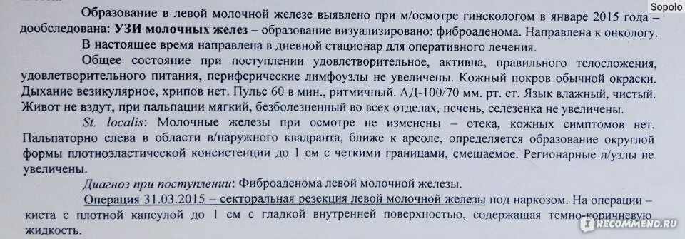 Удалить фиброаденому молочной железы отзывы. Фиброаденома молочной железы после операции. операция по удалению фиброаденомы груди. протокол операции удаление фиброаденомы молочной железы. выписка после операции.....молочной железы.
