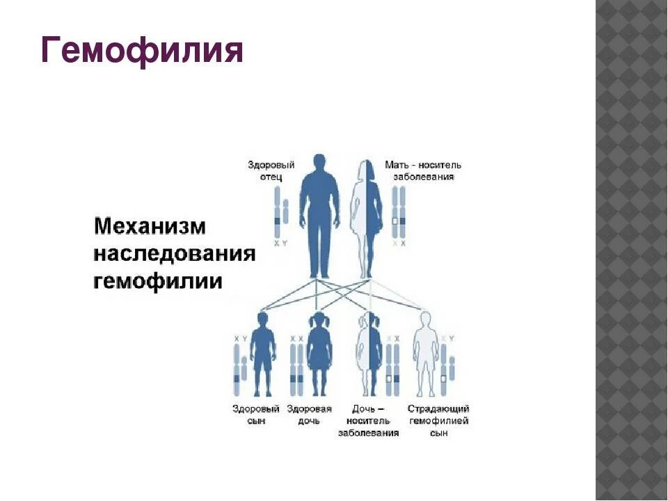 Дети больные гемофилией. Наследование признаков гемофилии. Гемофилия Тип наследования. Гемофилия генетика Тип наследования. Механизм наследования гемофилии.