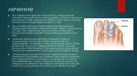 Большой палец на ноге сколько фаланг