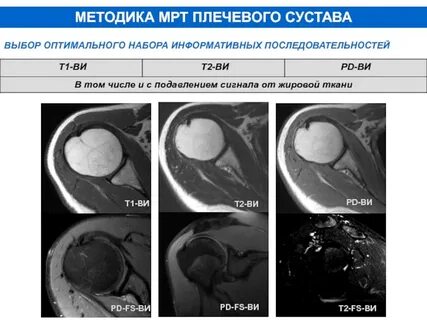 Мрт суставов омск