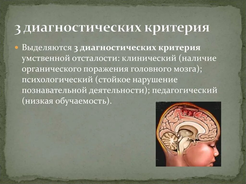 Мозг умственно отсталого ребенка. Мрт головного мозга при умственной отсталости. Мозг при умственной отсталости. Органическое поражение головного мозга. Необратимые нарушения головного мозга