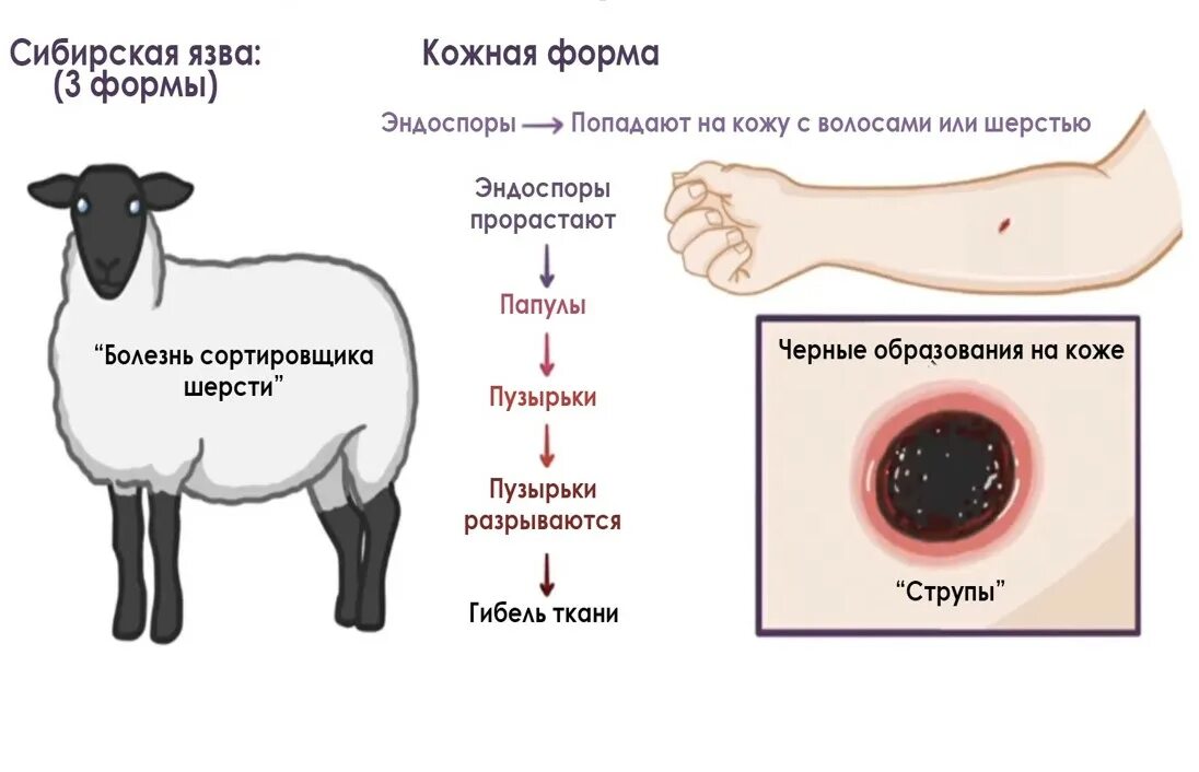 Основной метод лечения кожной формы сибирской язвы - фото презентация