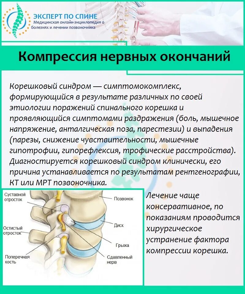 Чем лечить нерв в пояснице. Компрессия нервных Корешков позвоночника поясничного. Компрессия l5 корешка клиника. Компрессия s1 корешка позвоночника.. Компрессионно корешковый синдром поясничного отдела.