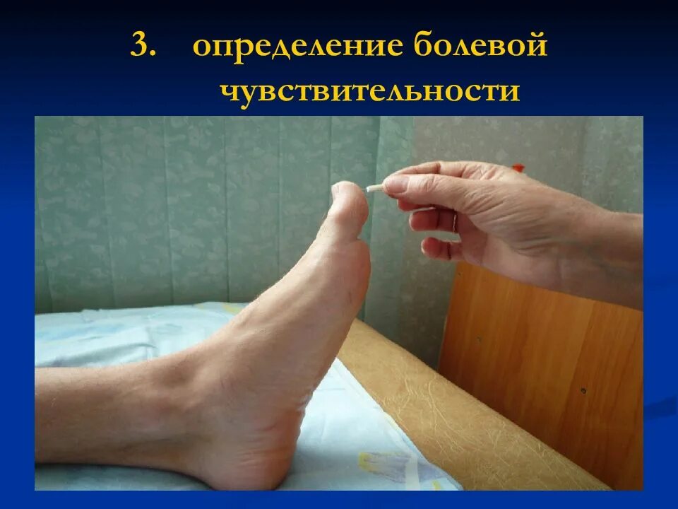 Определение болевой чувствительности. Полинейропатии методы исследования. Методика исследования чувствительности. Тактильная и болевая чувствительность. Исследование болевой и температурной чувствительности.