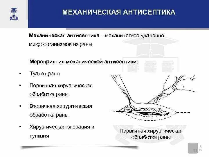 Заключающаяся в удалении. Заключающаяся в удалении