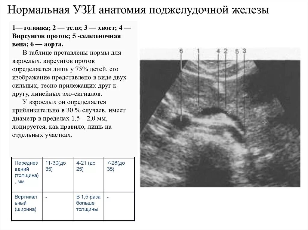 Поджелудочная железа узи норма у мужчин. УЗИ поджелудочной железы норма. Селезеночная Вена УЗИ анатомия. УЗИ поджелудочной железы расшифровка норма. УЗИ поджелудочной нормальные показатели.