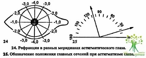 Пересчет астигматики линз для очков