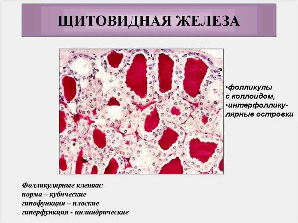 Интерфолликулярный эпителий щитовидная железа. Эндокринные клетки щитовидной железы. Щитовидная железа гистология интерфолликулярные островки. Коллоид фолликулов щитовидной железы.