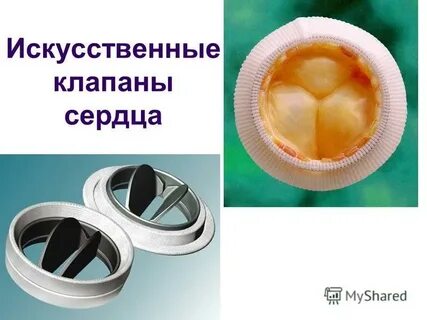 Аортальный клапан форум