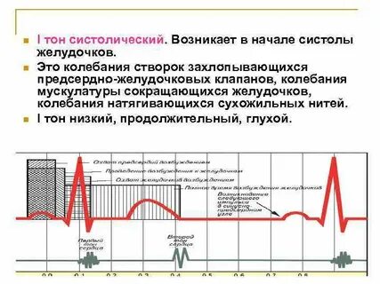 Систолический тон