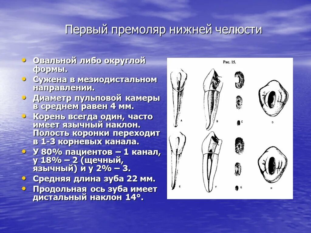 Верхние и нижние каналы. Первый премоляр корневой канал. Второй премоляр нижней челюсти анатомия корневых каналов. Второй премоляр нижней челюсти на челюсти. Анатомия корневых каналов премоляров верхней челюсти.