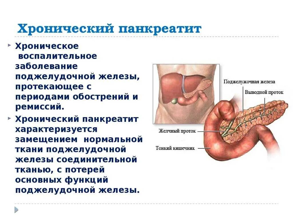 Панкреатит симптомы заболевания. Хронический панкреатит поджелудочная железа. Болезнь поджелудочной железы панкреатит. Симптомы острого панкреатита поджелудочной железы. Хронические заболевания поджелудочной железы.