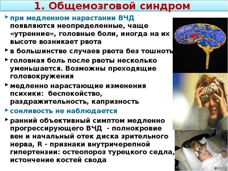 Головные боли при внутричерепном давлении. Головные боли при внутричерепном давлении