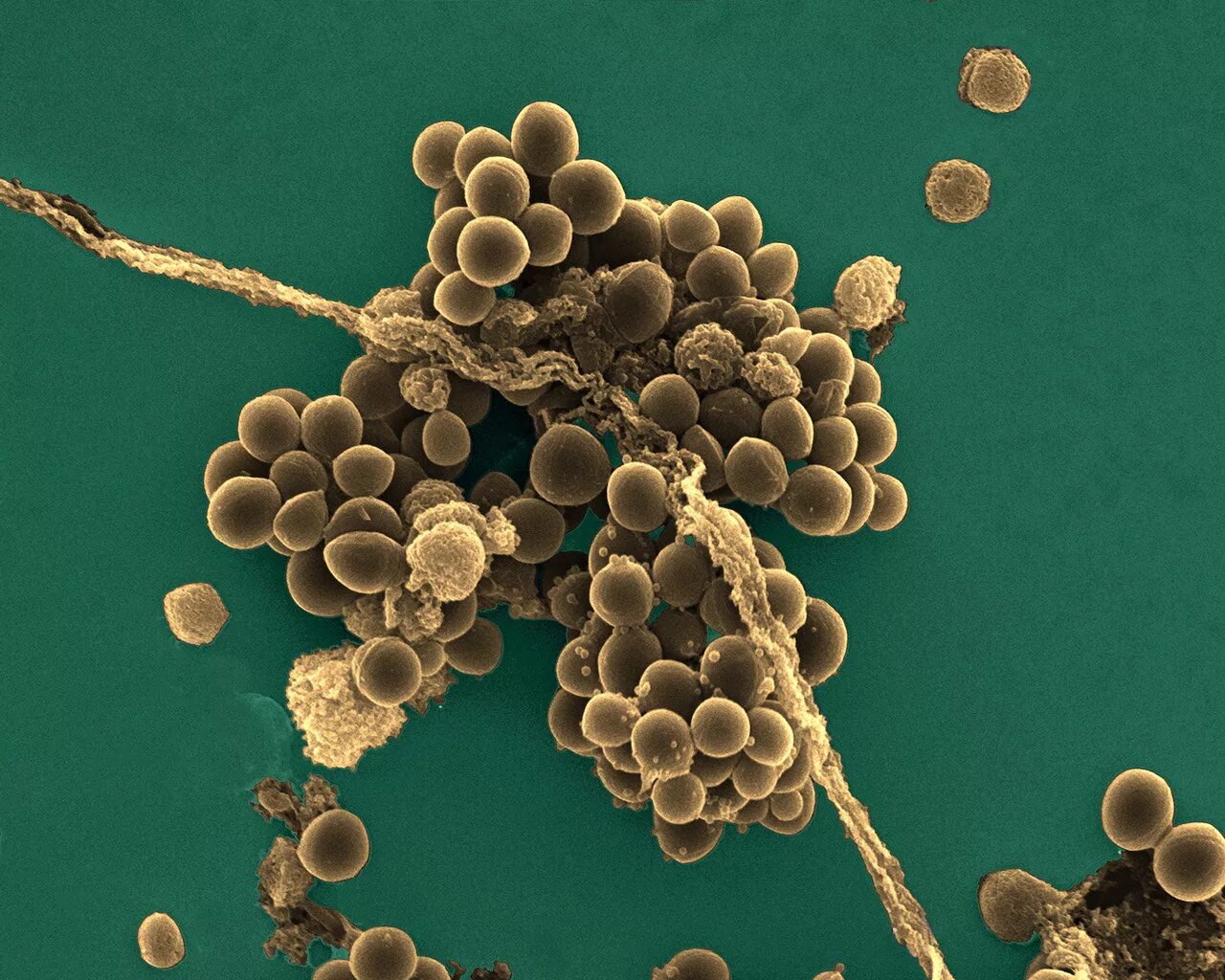 Золотистая инфекция. Стафилококк ауреус микроскоп. St. aureus (золотистый стафилококк. Стафилококк ауреус под микроскопом. Метициллинрезистентный золотистый стафилококк.