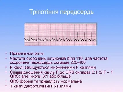 Ритм частота