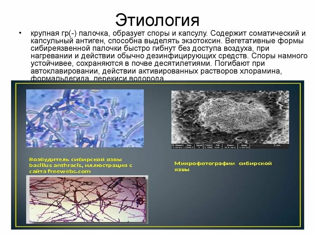 Возбудитель сибирской язвы пути передачи. Споры палочки сибирской язвы. Бацилла сибирской язвы строение. Сибирская язва этиология. Споры и вегетативные формы