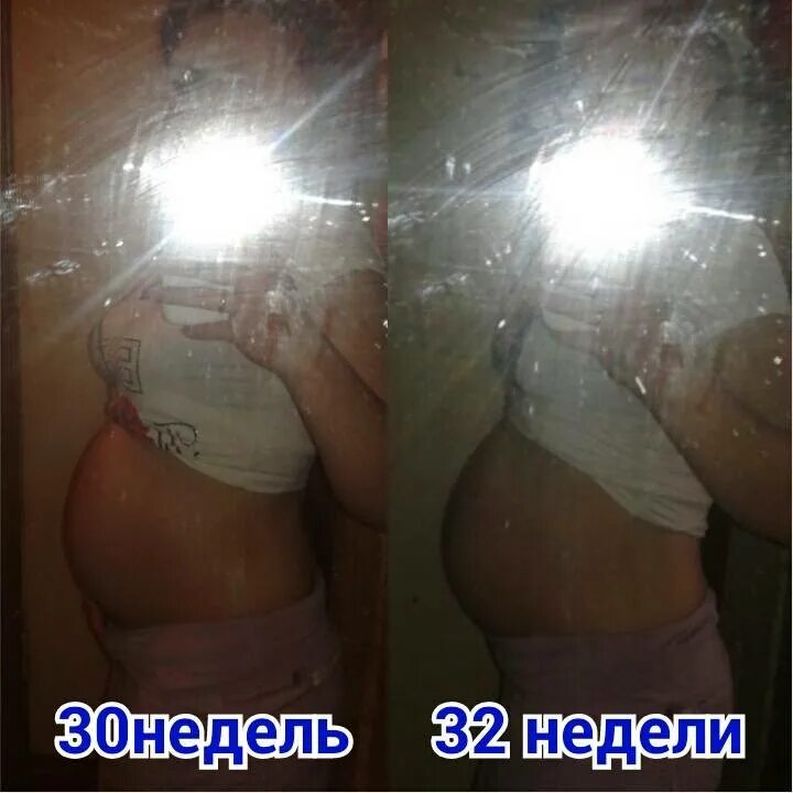 Выделяется из груди при беременности. Молозиво на 28 неделе беременности. Молозиво при беременности. Молозиво на 25 неделе беременности.
