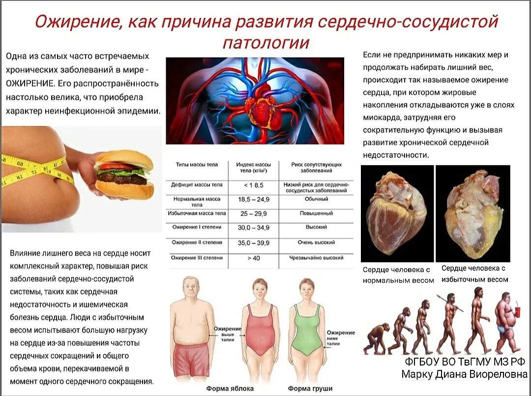 Ожирение и сердечно сосудистые заболевания. Ожирение как причина развития сердечно сосудистой патологии. Санбюллетень ожирение. Ожирение как причина развития сердечнососудистой патологии.