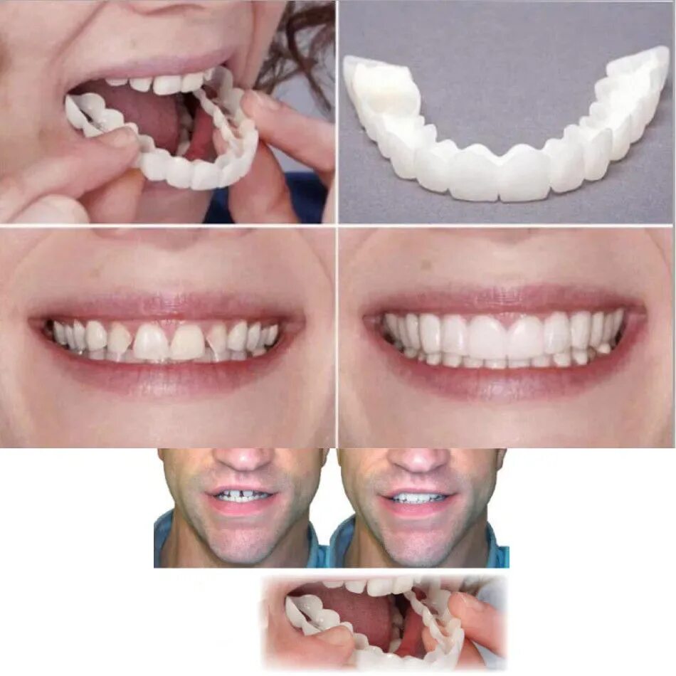 Гомель зубная поликлиника улыбка. Сделать зубы гомель. Гомель стоматология. Сделать зубы гомель. Сделать зубы гомель.