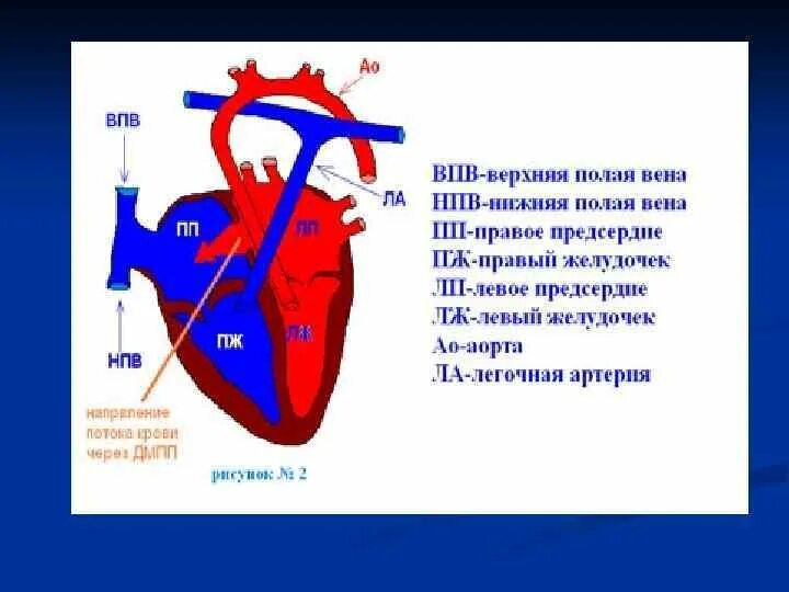 Добавочная верхняя полая Вена. Заслонка нижней полой вены. Добавочная левая верхняя полая Вена. Добавочная левосторонняя верхняя полая Вена.