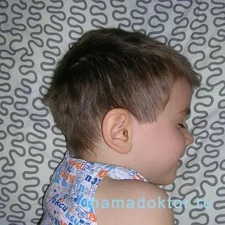 Отит компресс на ухо ребенку