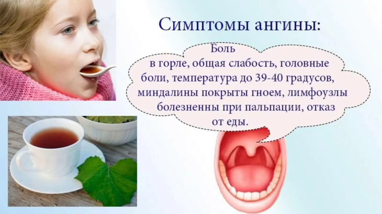 Лечение гнойной ангины быстро и эффективно