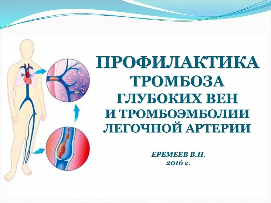 Профилактика тромбоза конечностей. Профилактика венозных тромбозов. Профилактика тромбоза глубоких вен. Профилактика тромбоэмболии, профилактика тромбоза глубоких вен. Профилактика тромбоэмболии глуюоких ве.