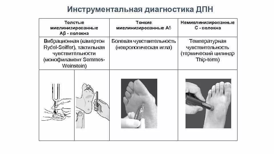 Исследование чувствительности при диабетической полинейропатии. ЭНМГ при диабетической полинейропатии. Неврологический набор для диагностики диабетической нейропатии. Неврологический статус при диабетической полинейропатии.