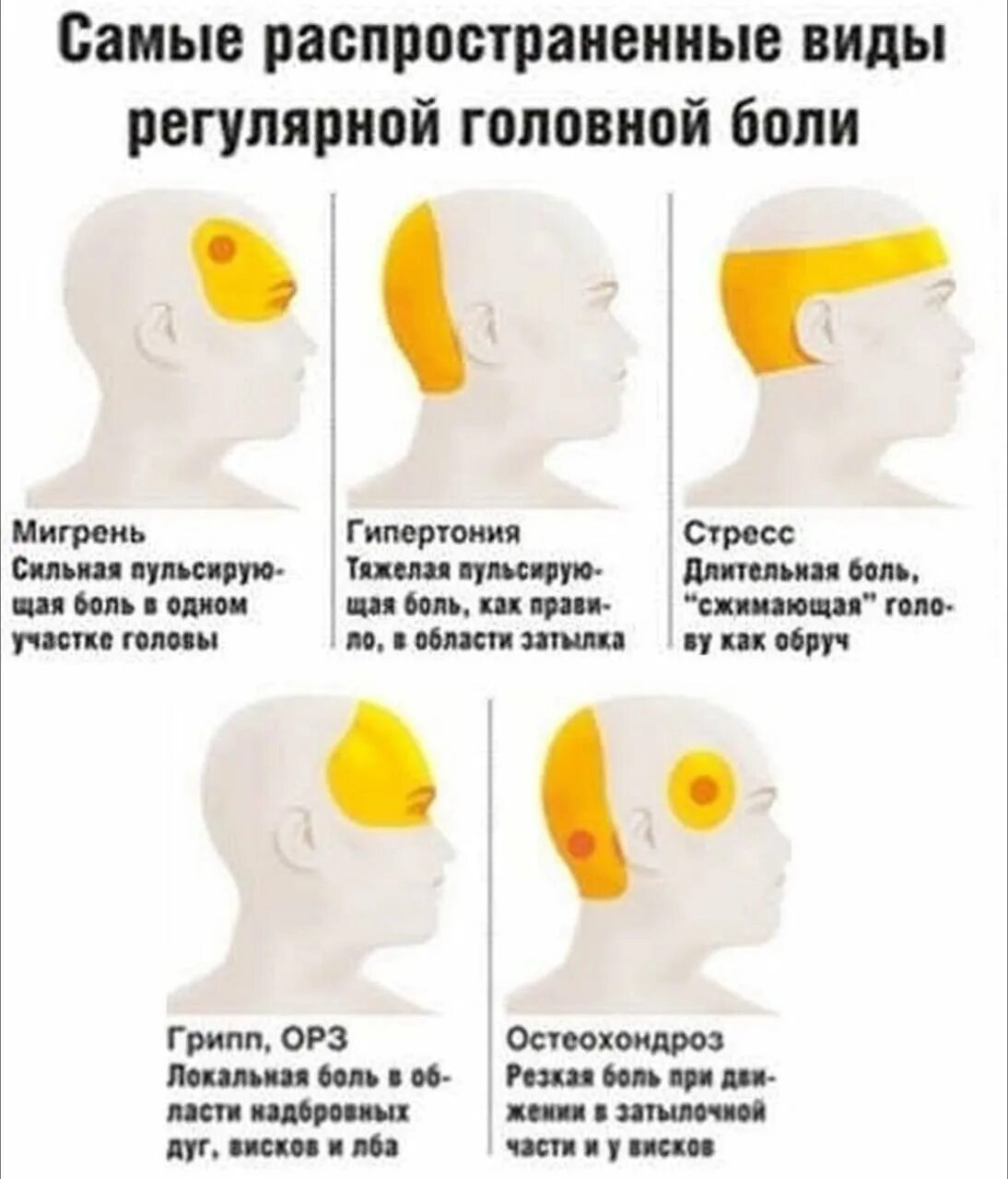 Болит лоб и температура. Головная боль. Типы головной боли. Головная боль локализация. Причины головной боли.