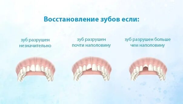 Какие реакции могут быть на зубы. Какие реакции могут быть на зубы