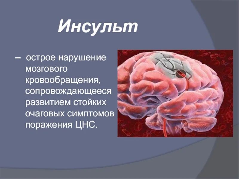 Нарушение мозгового кровообращения. Острое нарушение мозгового кровообращения (ОНМК). Нарушение кровообращения мозга. Поражение головного мозга.