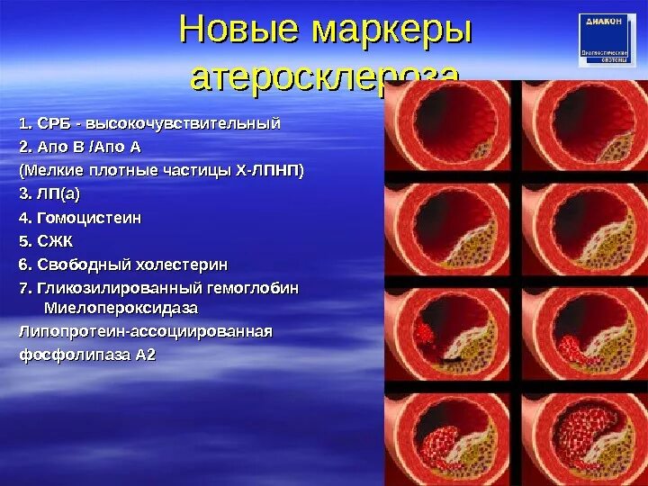 К атеросклерозу относят