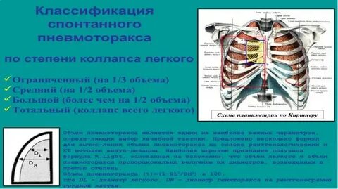 Клиническими проявлениями клапанного пневмоторакса являются